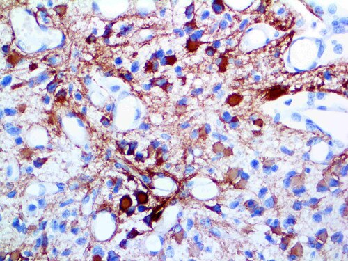 IHC of GFAP on an FFPE Brain Tissue